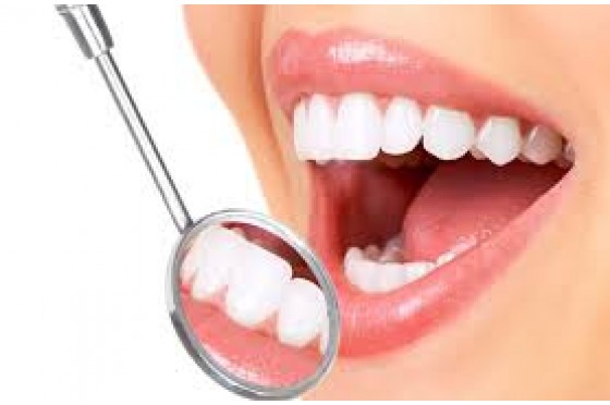 Thời gian làm răng sứ mất bao lâu?